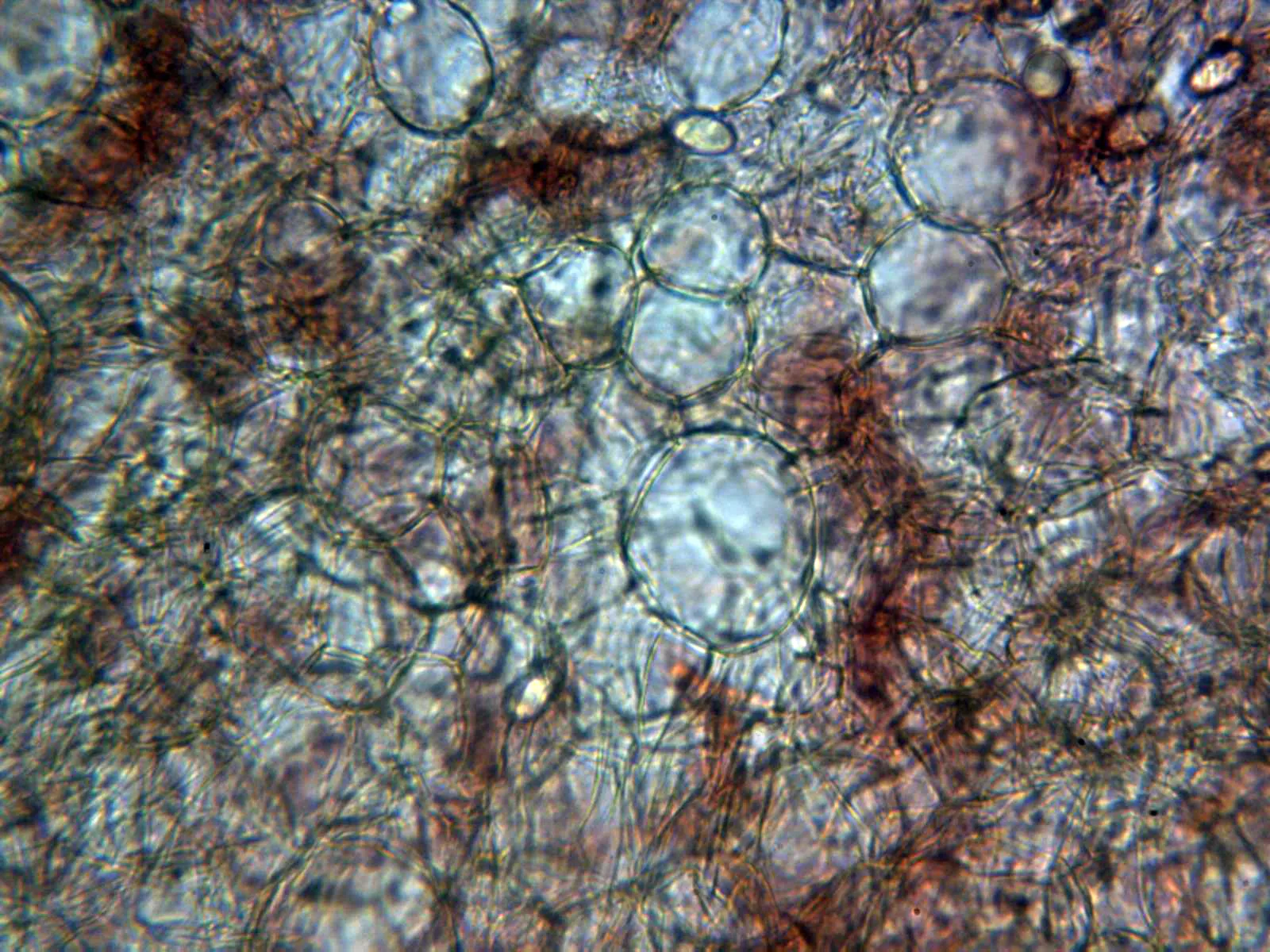 Microscopía de Peziza repanda - 10 - Excípulo ectal x 400